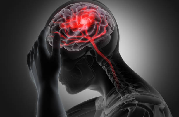 Начальные проявления недостаточности кровоснабжения головного мозга: симптомы и признаки